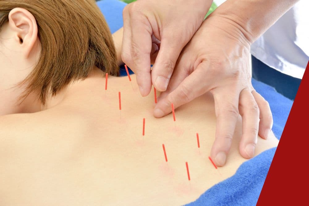 柔道整復師募集